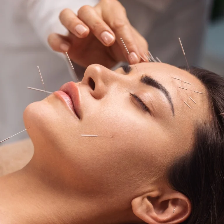 Annai Accupuncture
